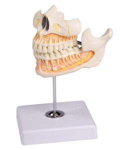 Volwassen Gebit Model