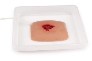 Wound Packing Wond Model