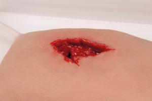 Wound Packing Wond Model