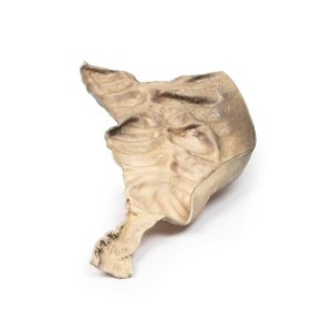 Ziekte van Hirschsprung, 3D Print