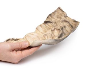 Ziekte van Hirschsprung, 3D Print