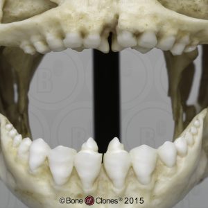 Zwarte Pacu Schedelmodel